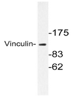 AP06605PU-N - Vinculin (VCL)