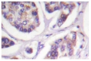 AP06605PU-N - Vinculin (VCL)