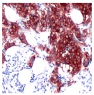 AM09107PU-N - MAPT / TAU