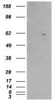 AP16283PU-N - RXR-beta / RXRB