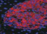AP09568PU-N - UNC5C