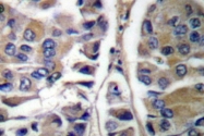 AP06202PU-N - Cytokeratin 20