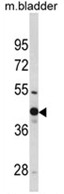 AP18243PU-N - WNT4