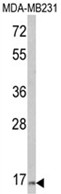 AP18229PU-N - Thyrotropin beta chain