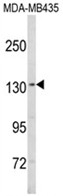 AP18209PU-N - SREBF1 / SREBP1