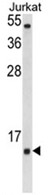 AP18205PU-N - Superoxide Dismutase 1 / SOD1