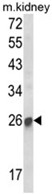 AP18204PU-N - SOCS1