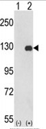 AP18170PU-N - FAK1 / PTK2