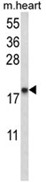 AP18139PU-N - Atrial Natriuretic Factor (ANF)