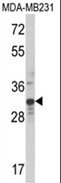 AP18116PU-N - Max-like protein X