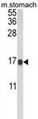 AP18097PU-N - Galectin-2