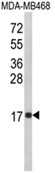 AP18073PU-N - Interleukin-8 / IL8