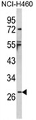 AP18071PU-N - Interleukin-1 beta / IL-1B