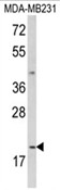 AP18069PU-N - Interleukin-12 alpha / IL12A
