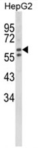 AP18045PU-N - Beta-hexosaminidase alpha / HEXA