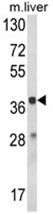 AP18044PU-N - Hydroxyacid oxidase 1 / HAOX1