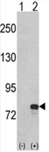 AP18038PU-N - GMP synthetase / GMPS