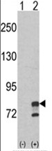 AP18037PU-N - GMP synthetase / GMPS