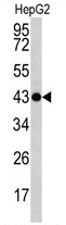 AP17084PU-N - Actin gamma / ACTG