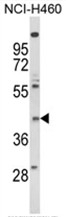 AP18025PU-N - FMLP-related receptor II
