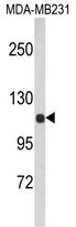 AP17086PU-N - Alpha-actinin-1 / ACTN1