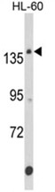 AP18023PU-N - FNDC3B