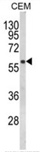 AP18021PU-N - Folliculin