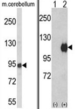 AP18009PU-N - Autotaxin / ENPP2