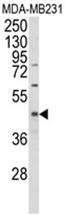 AP18002PU-N - EGLN2 / PHD1