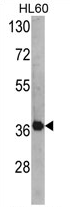 AP17095PU-N - AHA1 / AHSA1