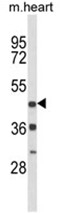 AP17995PU-N - Dopamine D4 receptor