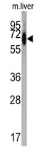 AP17100PU-N - Albumin
