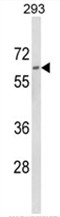 AP17992PU-N - Dolichol kinase