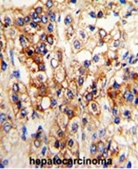 AP17970PU-N - CYP2J2