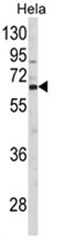 AP17959PU-N - CTP synthase 2