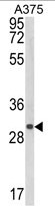 AP17958PU-N - CTHRC1