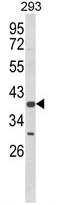 AP17956PU-N - CSGALNACT2