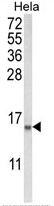 AP17951PU-N - Coactosin-like protein
