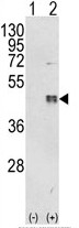 AP17939PU-N - CEBPB