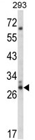 AP17935PU-N - CDC42EP3