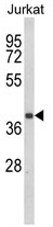 AP17930PU-N - CD193 / CCR3
