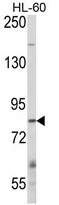 AP17925PU-N - CBLB / RNF56