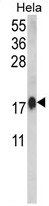 AP17918PU-N - Calmodulin