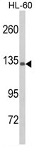 AP17914PU-N - Complement C5