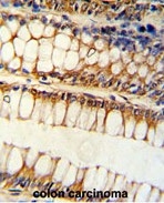 AP17900PU-N - Bcl-2-like 11