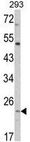 AP17896PU-N - ATP synthase subunit O
