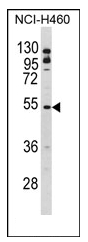 AP17153PU-N - B-cell linker protein / BLNK