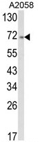 AP17892PU-N - ATF6 alpha