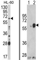 AP17890PU-N - Arylsulfatase B