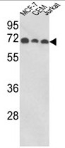 AP17861PU-N - ABI1 / SSH3BP1